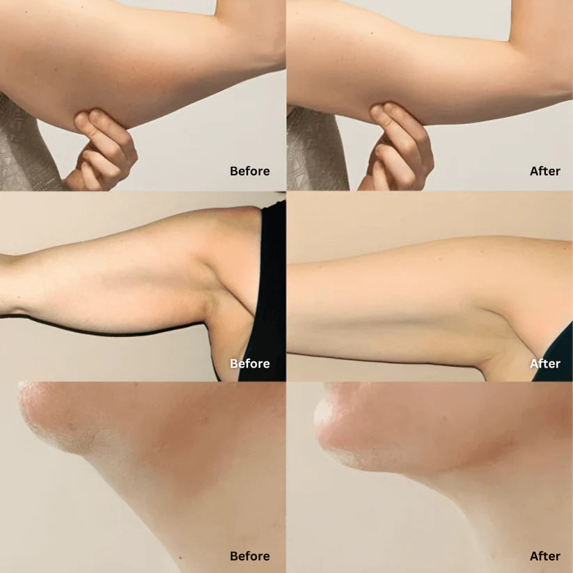 Mezcla de hierbas orgánicas para el apoyo linfático